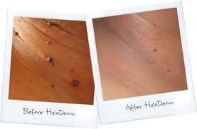 New Haloderm Advanced Skin Tag Remover & Mole Remover Kit - All Natural  Skin Tag Cream - Fast