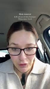 I had talked to @km.microbladingandskin.pn a while ago about removing my  moles the last time I went in and I finally went back in to get them done.  Karyn used a local cream anaesthetic