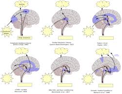 Must be love on the brain yeah. Emotion Wikipedia