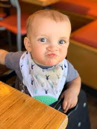 Rescued pitbull with cleft lip finds love and support