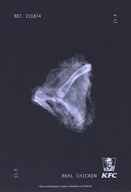 Kfc Outdoor Advert By Ps21 Chicken X Rays Ads Of The World Kfc X Ray Food Quality