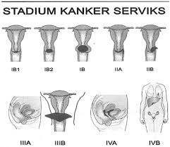 We did not find results for: Http Eprints Ums Ac Id 9913 1 K100060069 Pdf
