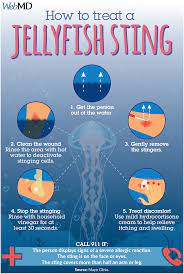 Jellyfish Stings Treatment Jellyfish Sting Jellyfish Jellyfish Facts