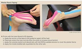 Image result for Taping for Soleus and Achilles