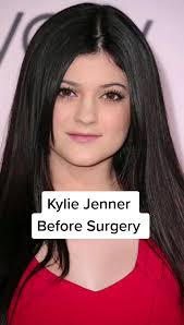 The kid looks really, really different. Scopri I Video Piu Popolari Di Kylie Jenner Before Tiktok