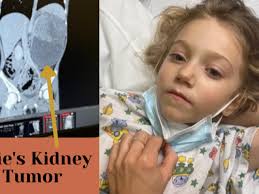 Fundraiser by Mardie Christensen : Little Ellie's Fight with Kidney Cancer