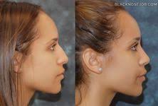 10 Best Straight nose ideas