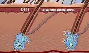 Bittorrent dht is the main peer discovery layer for bittorrent, which allows for trackerless. Dihydrotestosterone Dht Blocker Market 2020 2028 Permanent