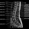 Cysts that appear on your back can quickly become painful and irritated. Https Encrypted Tbn0 Gstatic Com Images Q Tbn And9gcsp9w0idmqbi K4vbuzsnepbbm6adflj W1xvhxho3gsdkdaxka Usqp Cau