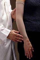 The Role Of Compression Garments In The Treatment Of Lymphedema Lymphedema Blog