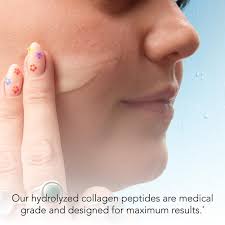 Perfect for trouble areas