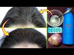 Get Rid Of White Hair Naturally At Young Age Best Home Remedy For Gray Hair Turns Into B Hair Growth Home Remedies Natural Hair Styles Home Remedies For Hair