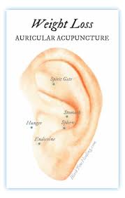 pin on acupuncture