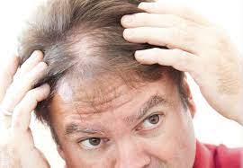 Take coconut or olive oil. 9 Expert Hair Care Tips For Men Hair And Beauty