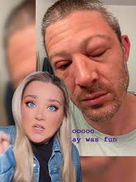 What Happened to Matt Folsom