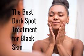 Discover serums, creams & more that eliminate dark spots & even skin tone for a gorgeous complexion. The Best Dark Spot Treatment For Black Skin Tonique Skincare