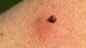 Que les scientifiques, médecins, etc … ont souvent des points de vue très opposé.pourtant c'est une maladie qui touche. Tout Savoir Sur La Maladie De Lyme