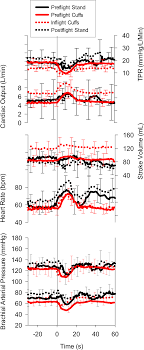 Inflight Leg Cuff Test Does Not Identify The Risk For