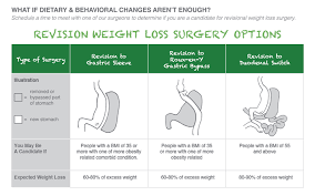 bariatric weight loss surgery revision
