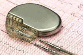 Mentre aspettate l'arrivo del soccorso e dell'ambulanza, e se non fosse subito disponibile il defibrillatore, iniziate le manovre di rianimazione cardiopolmonare, alternando il massaggio cardiaco. Defibrillatore Cardiaco Impiantabile Af Ablation
