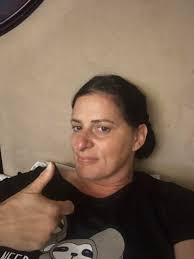 What to expect after hip replacement surgery at 6 days post-op?