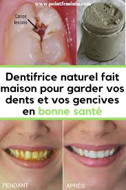 Pin On Astuces Pour Etre Belle Tout Le Temps