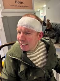 Lost Balance Guy strikes again! This is your periodic reminder that living  with a disability can be shit sometimes, however well your life is going. I  fell and split my head over