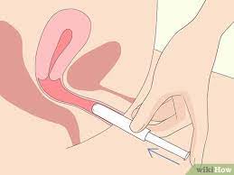 J'ai lu la notice et de nombreux forums, mais cela ne m'aide en rien. 10 Manieres De Mettre Un Tampon Wikihow