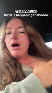 Allergic Reaction to Mary Ruth Vitamins Rash