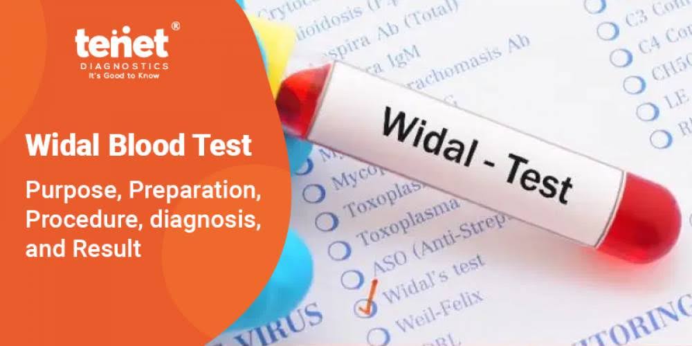 WIDAL SLIDE product image