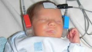 They had hoped for at least 10 people to be waiting at the hospital for her first baby's arrival. Newborn Hearing Screening Faqs Healthychildren Org