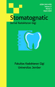 Suggestions will appear below the field as you type. Pemanfaatan Sistem Informasi Geografis Untuk Pemantauan Karies Di Wilayah Kerja Puskesmas Ambulu Kabupaten Jember Stomatognatic Jurnal Kedokteran Gigi