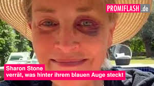 Sharon Stone verrät, was hinter ihrem blauen Auge steckt