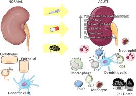 Ultrasound findings in renal parenchymal disease: Frontiers Inflammation In Renal Diseases New And Old Players Pharmacology