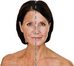 Rejuvenation is an aura mod that regenerates all team members' health every second. Ellipse Skin Rejuvenation Dr Kurgis