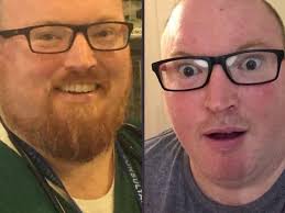 Fundraiser for Peter Russell-Schleh by Anna Blackwell : Dr Russell's beard  vs Covid