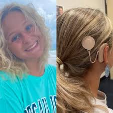 Hellow Fellow Hearing Loss Tribe Members: My memoir about what it's like to  suffer sudden, adult-onset deafness was recently published in the U.K.  "Hear Today, Gone Tomorrow: A True Story of Love,