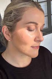 What Caused My Cystic Acne? The Unexpected Cause