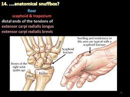 Anatomy Of The Hand In 14 Questions Kaan Yucel M D Ph D Ppt Video Online Download Lesson on clinical examination of a scaphoid fracture and assessment of the anatomic snuffbox. questions kaan yucel m d ph d