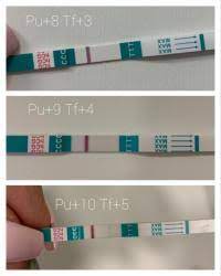 Die rate eineiiger zwillinge nach blastozystentransfer wird in retrospektiven studien mit 4,3 % höher angegeben als nach frühem transfer und wird. Pu 8 Blastozystentransfer Tf 3 Sst Negativ Noch Hoffnung Urbia De