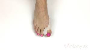 Image result for vybočený palec ortéza