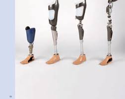 Atau anda dapat klik di website utama kami di jop.co.id jika anda belum tahu produk yang sesuai dengan kondisi yang anda alami saat ini. Kaki Palsu Jani Orthoprost