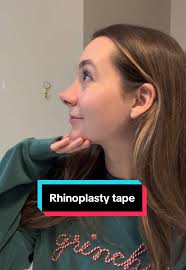 Madelyn's Rhinoplasty Taping Routine Explained