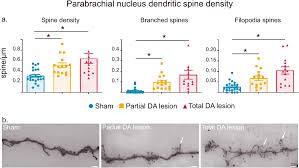 Image result for Paraknoxia
