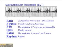 Pin On Cardiac