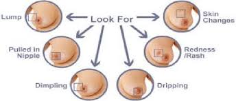 Both conditions bring about symptoms such as abnormal vaginal bleeding, pain during intercourse, and pelvic pain. Signs Of Breast Cancer Download Scientific Diagram