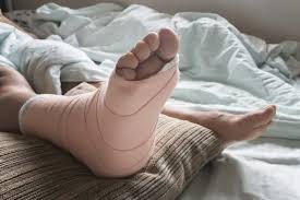 Image result for Foot Fracture