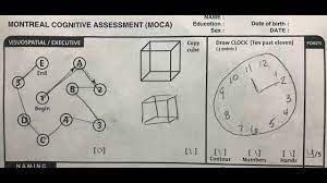 This test is easier to complete than the mmse for people with short. Montreal Cognitive Assessment Moca Instructional Video Youtube