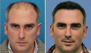Pin On Hair Solution In Dubai