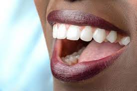 All about temporary and permanent dentures. How Long Will It Take To Recover From A Full Mouth Reconstruction Lifetime Dental Tavares Florida